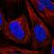 Centrosomal Protein 164 antibody, HPA037606, Atlas Antibodies, Immunocytochemistry image 