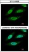 Casein Kinase 2 Beta antibody, GTX113335, GeneTex, Immunofluorescence image 