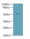 Zinc Finger Protein 410 antibody, LS-C394909, Lifespan Biosciences, Western Blot image 