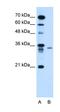 Lymphocyte Antigen 6 Family Member G6F antibody, orb325149, Biorbyt, Western Blot image 