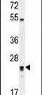 Deleted In Primary Ciliary Dyskinesia Homolog (Mouse) antibody, PA5-26825, Invitrogen Antibodies, Western Blot image 