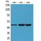 KIR3DL3 antibody, LS-C387031, Lifespan Biosciences, Western Blot image 