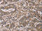 Four And A Half LIM Domains 1 antibody, CSB-PA295162, Cusabio, Immunohistochemistry paraffin image 