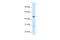 Enoyl-CoA hydratase, mitochondrial antibody, 30-102, ProSci, Western Blot image 