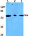 TNF Receptor Superfamily Member 10a antibody, GTX66667, GeneTex, Western Blot image 