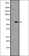 Src-Related Kinase Lacking C-Terminal Regulatory Tyrosine And N-Terminal Myristylation Sites antibody, orb335492, Biorbyt, Western Blot image 