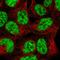 Small Nuclear Ribonucleoprotein Polypeptide B2 antibody, HPA050814, Atlas Antibodies, Immunofluorescence image 