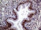 MAGE Family Member B4 antibody, M14698-1, Boster Biological Technology, Immunohistochemistry paraffin image 