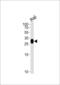 Major Histocompatibility Complex, Class II, DR Beta 4 antibody, 57-203, ProSci, Western Blot image 