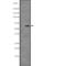 Sequestosome 1 antibody, PA5-67516, Invitrogen Antibodies, Western Blot image 