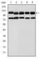 Bone Morphogenetic Protein Receptor Type 2 antibody, MA5-15826, Invitrogen Antibodies, Western Blot image 