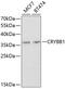 Crystallin Beta B1 antibody, 18-728, ProSci, Western Blot image 