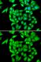 NIMA Related Kinase 3 antibody, GTX33352, GeneTex, Immunocytochemistry image 