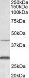 C-X-C Motif Chemokine Receptor 2 antibody, MBS422759, MyBioSource, Western Blot image 
