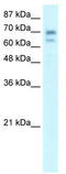 HR Lysine Demethylase And Nuclear Receptor Corepressor antibody, TA332071, Origene, Western Blot image 