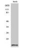 Diazepam Binding Inhibitor, Acyl-CoA Binding Protein antibody, A01267-2, Boster Biological Technology, Western Blot image 