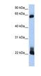 Ras Homolog Family Member D antibody, NBP1-58359, Novus Biologicals, Western Blot image 