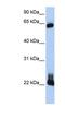 Rho-related GTP-binding protein RhoD antibody, NBP1-58359, Novus Biologicals, Western Blot image 