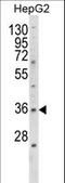 E2F Transcription Factor 5 antibody, LS-C167599, Lifespan Biosciences, Western Blot image 