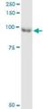 Rac/Cdc42 Guanine Nucleotide Exchange Factor 6 antibody, H00009459-M02, Novus Biologicals, Immunoprecipitation image 