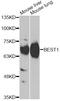 Bestrophin 1 antibody, A14070, ABclonal Technology, Western Blot image 