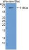 Tau Tubulin Kinase 1 antibody, abx131659, Abbexa, Western Blot image 