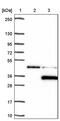 Lysophospholipase Like 1 antibody, PA5-61097, Invitrogen Antibodies, Western Blot image 