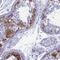 MAGE Family Member B6 antibody, PA5-59756, Invitrogen Antibodies, Immunohistochemistry paraffin image 