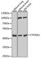 Cytochrome P450 Family 20 Subfamily A Member 1 antibody, STJ28559, St John