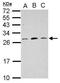 Mitochondrial Ribosomal Protein L18 antibody, GTX121511, GeneTex, Western Blot image 
