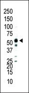 Mitogen-Activated Protein Kinase 9 antibody, 62-957, ProSci, Western Blot image 