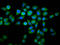 WD Repeat And FYVE Domain Containing 2 antibody, LS-C681706, Lifespan Biosciences, Immunofluorescence image 