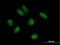TRNA Methyltransferase 9B (Putative) antibody, H00057604-B01P, Novus Biologicals, Immunocytochemistry image 