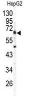 G4S antibody, AP14108PU-N, Origene, Western Blot image 