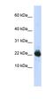 Ubiquitin Conjugating Enzyme E2 L3 antibody, orb330274, Biorbyt, Western Blot image 