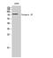 Calpain 10 antibody, A03289, Boster Biological Technology, Western Blot image 