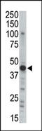 Protein Kinase CAMP-Dependent Type II Regulatory Subunit Beta antibody, AP13605PU-N, Origene, Western Blot image 