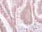 Nuclear Receptor Subfamily 3 Group C Member 1 antibody, NBP2-42221, Novus Biologicals, Immunohistochemistry paraffin image 