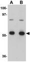 Cell Division Cycle 23 antibody, GTX17066, GeneTex, Western Blot image 