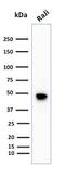 CD79a antibody, GTX34562, GeneTex, Western Blot image 