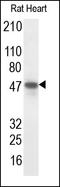 Intermediate conductance calcium-activated potassium channel protein 4 antibody, 251868, Abbiotec, Western Blot image 