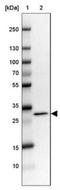 RCC1 And BTB Domain Containing Protein 2 antibody, NBP1-85636, Novus Biologicals, Western Blot image 
