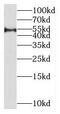 Mirror-Image Polydactyly 1 antibody, FNab05196, FineTest, Western Blot image 