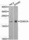 p21 antibody, STJ111165, St John