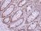 DEAD-Box Helicase 3 X-Linked antibody, PA5-29170, Invitrogen Antibodies, Immunohistochemistry paraffin image 