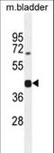 SH2 Domain Containing 5 antibody, LS-C169058, Lifespan Biosciences, Western Blot image 