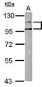Discoidin Domain Receptor Tyrosine Kinase 1 antibody, NBP1-33134, Novus Biologicals, Western Blot image 