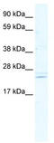 Achaete-Scute Family BHLH Transcription Factor 2 antibody, TA341790, Origene, Western Blot image 