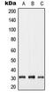 Gap Junction Protein Beta 5 antibody, GTX55992, GeneTex, Western Blot image 