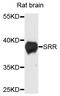 Serine racemase antibody, STJ111657, St John